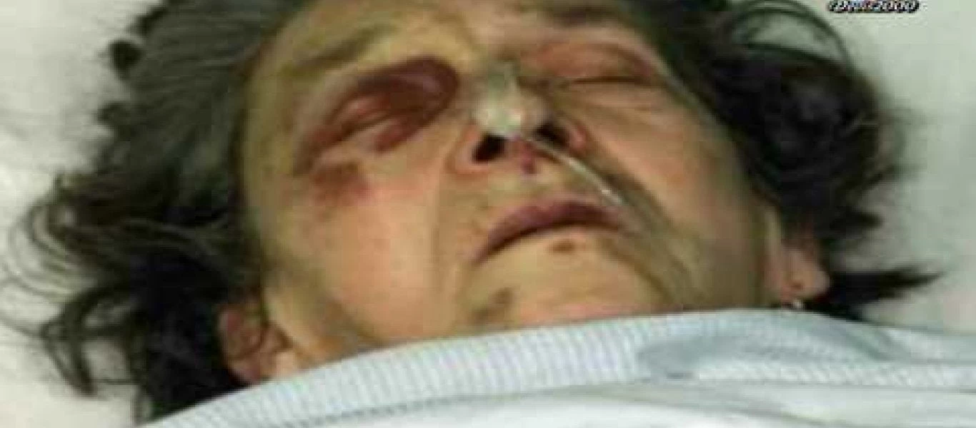 Βίντεο: Τα απάνθρωπα εγκλήματα των Αλβανών κατά των Σέρβων στο Κόσοβο